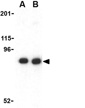 Western blot - Anti-H Cadherin antibody (AB36905)