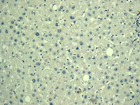 Immunohistochemistry (Formalin/PFA-fixed paraffin-embedded sections) - Anti-H Cadherin antibody [EPR9621] (AB167407)