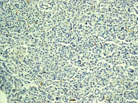 Immunohistochemistry (Formalin/PFA-fixed paraffin-embedded sections) - Anti-H Cadherin antibody [EPR9621] (AB167407)