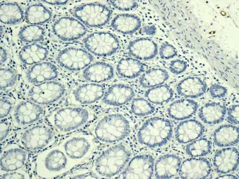 Immunohistochemistry (Formalin/PFA-fixed paraffin-embedded sections) - Anti-H Cadherin antibody [EPR9621] (AB167407)