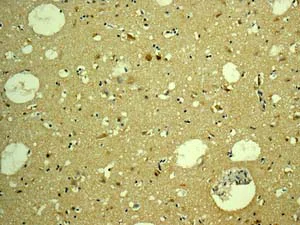 Immunohistochemistry (Formalin/PFA-fixed paraffin-embedded sections) - Anti-H Cadherin antibody [EPR9621] - BSA and Azide free (AB249422)