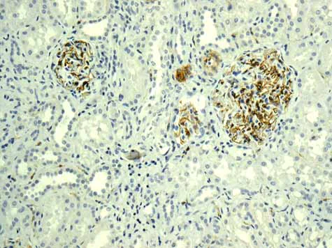 Immunohistochemistry (Formalin/PFA-fixed paraffin-embedded sections) - Anti-H Cadherin antibody [EPR9621] - BSA and Azide free (AB249422)