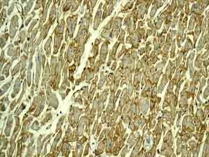 Immunohistochemistry (Formalin/PFA-fixed paraffin-embedded sections) - Anti-H Cadherin antibody [EPR9621] - BSA and Azide free (AB249422)