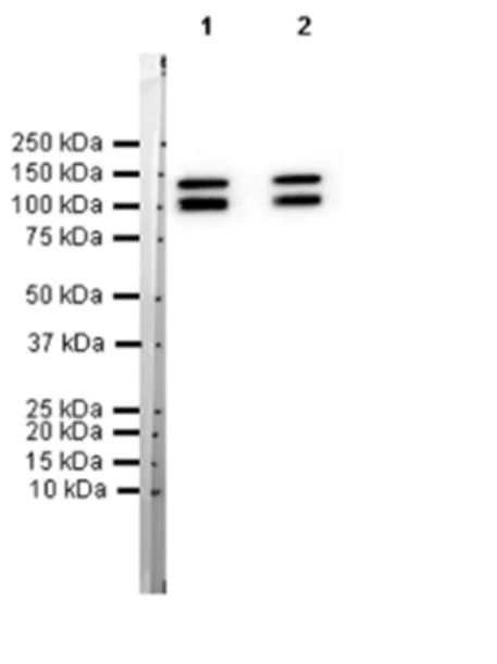 Western blot - Anti-H Cadherin antibody [EPR9621] - BSA and Azide free (AB249422)