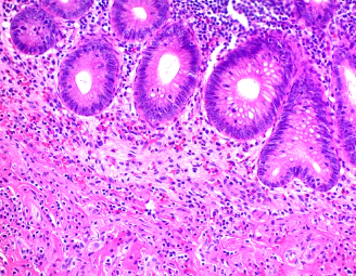 Immunohistochemistry (Formalin/PFA-fixed paraffin-embedded sections) - H&E Staining Kit (Hematoxylin and Eosin) (AB245880)