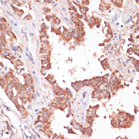 Immunohistochemistry (Formalin/PFA-fixed paraffin-embedded sections) - Anti-H-ERG antibody (AB192500)