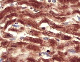 Immunohistochemistry (Formalin/PFA-fixed paraffin-embedded sections) - Anti-H-ERG antibody (AB196301)