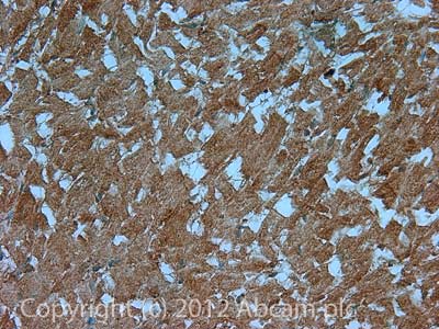 Immunohistochemistry (Formalin/PFA-fixed paraffin-embedded sections) - Anti-H-FABP antibody [67D3] (AB16916)