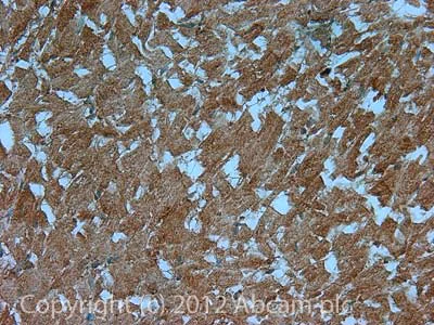 Immunohistochemistry (Formalin/PFA-fixed paraffin-embedded sections) - Anti-H-FABP antibody [67D3] (AB16916)