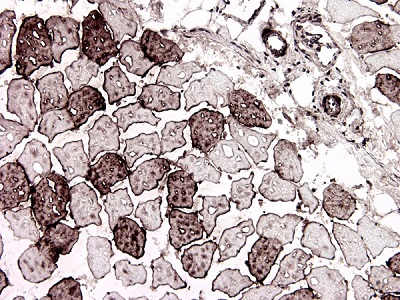 Immunohistochemistry (Frozen sections) - Anti-H-FABP antibody [67D3] (AB16916)