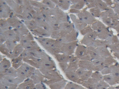 Immunohistochemistry (Formalin/PFA-fixed paraffin-embedded sections) - Anti-H-FABP antibody (AB231568)