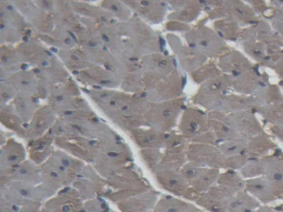 Immunohistochemistry (Formalin/PFA-fixed paraffin-embedded sections) - Anti-H-FABP antibody (AB231568)