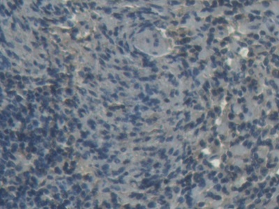Immunohistochemistry (Formalin/PFA-fixed paraffin-embedded sections) - Anti-H-FABP antibody (AB231568)