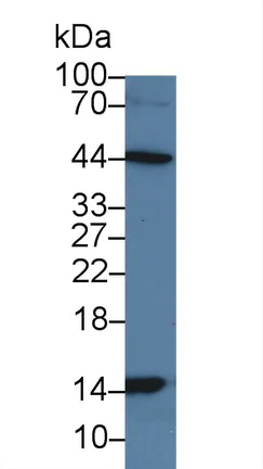 Western blot - Anti-H-FABP antibody (AB231568)