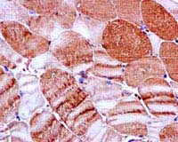 Immunohistochemistry (Formalin/PFA-fixed paraffin-embedded sections) - Anti-H-FABP antibody [EPR6127] - BSA and Azide free (AB248085), expandable thumbnail