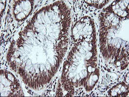 Immunohistochemistry (Formalin/PFA-fixed paraffin-embedded sections) - Anti-H-protein antibody [OTI3G1] (AB156763)
