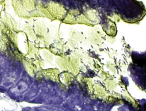 Immunohistochemistry (Formalin/PFA-fixed paraffin-embedded sections) - H. Pylori Stain Kit (Microorganism Stain) (AB150673), expandable thumbnail