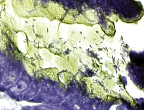 Immunohistochemistry (Formalin/PFA-fixed paraffin-embedded sections) - H. Pylori Stain Kit (Microorganism Stain) (AB150673)