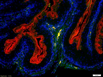 Immunohistochemistry (Formalin/PFA-fixed paraffin-embedded sections) - Anti-H2R antibody (AB215992)