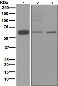 Western blot - Anti-H2R antibody [EPR5630] (AB108540), expandable thumbnail