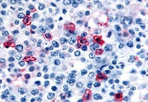 Immunohistochemistry (Formalin/PFA-fixed paraffin-embedded sections) - Anti-H4R antibody (AB188978)