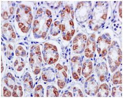 Immunohistochemistry (Formalin/PFA-fixed paraffin-embedded sections) - Anti-H6PD/GDH antibody [EPR12338(B)] (AB170895), expandable thumbnail