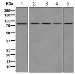 Western blot - Anti-H6PD/GDH antibody [EPR12338(B)] (AB170895), expandable thumbnail
