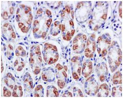 Immunohistochemistry (Formalin/PFA-fixed paraffin-embedded sections) - Anti-H6PD/GDH antibody [EPR12338(B)] - BSA and Azide free (AB249573)