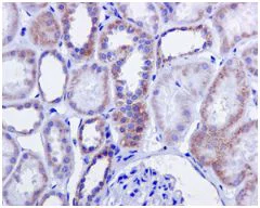 Immunohistochemistry (Formalin/PFA-fixed paraffin-embedded sections) - Anti-H6PD/GDH antibody [EPR12338(B)] - BSA and Azide free (AB249573)