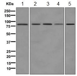 Western blot - Anti-H6PD/GDH antibody [EPR12338(B)] - BSA and Azide free (AB249573)