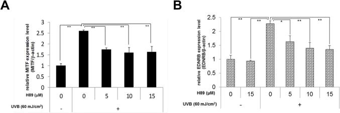 Functional Studies - H89 dihydrochloride, Kinase inhibitor (AB120341)
