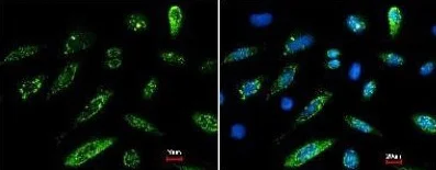 Immunocytochemistry/ Immunofluorescence - Anti-HA tag antibody (AB137838)