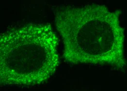 Immunocytochemistry/ Immunofluorescence - Anti-HA tag antibody - ChIP Grade (AB9110)