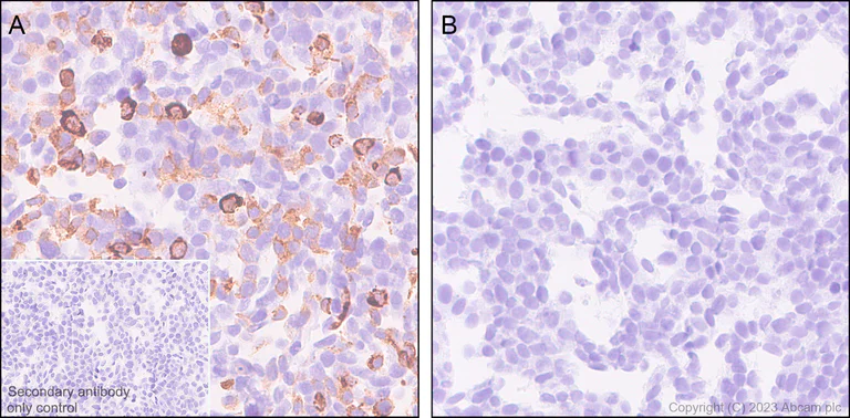 Immunohistochemistry (Formalin/PFA-fixed paraffin-embedded sections) - Anti-HA tag antibody [EPR22819-101] - BSA and Azide free (AB256483)