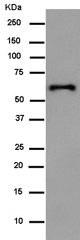 Western blot - Anti-HA tag antibody [EPR4095] (AB182009)