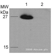 Western blot - Anti-HA tag antibody [HA.C5] (AB18181)