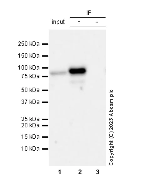 Immunoprecipitation - Anti-HA tag antibody [RM1058] (AB314237)