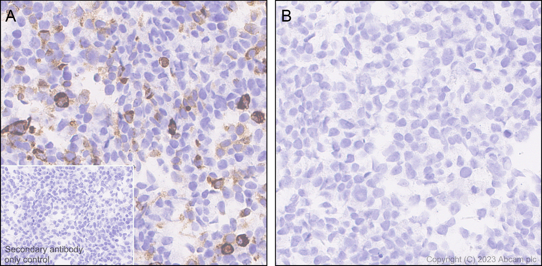 Immunohistochemistry (Formalin/PFA-fixed paraffin-embedded sections) - Anti-HA tag antibody [RM1058] - BSA and Azide free (ab314238), expandable thumbnail