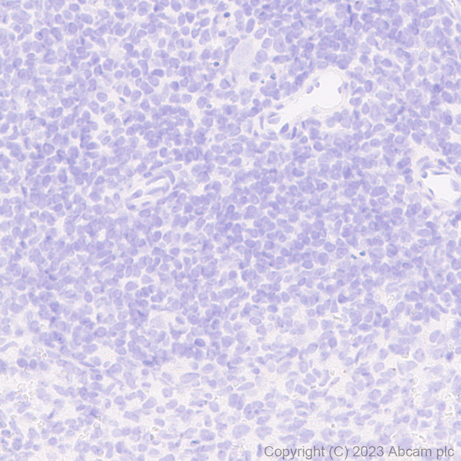 Immunohistochemistry (Formalin/PFA-fixed paraffin-embedded sections) - Anti-HA tag antibody [RM1058] - BSA and Azide free (AB314238), expandable thumbnail