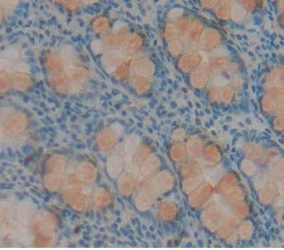 Immunohistochemistry (Formalin/PFA-fixed paraffin-embedded sections) - Anti-HABP2 antibody (AB232778)