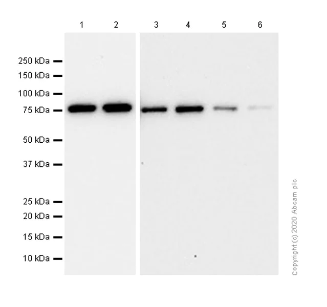 Western blot - Anti-HABP2 antibody [EPR14551] (AB181837)
