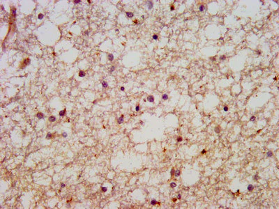 Immunohistochemistry (Formalin/PFA-fixed paraffin-embedded sections) - Anti-HACE1 antibody (AB237045)