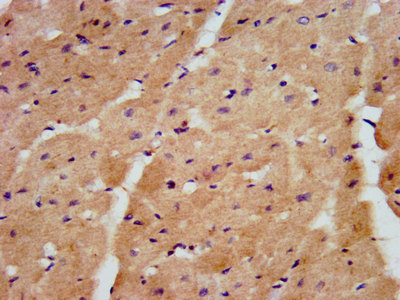 Immunohistochemistry (Formalin/PFA-fixed paraffin-embedded sections) - Anti-HACE1 antibody (AB237045)