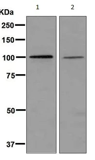 Western blot - Anti-HACE1 antibody [EPR7962] (AB133637)