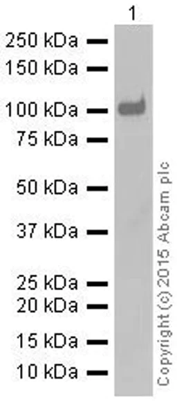 Western blot - Anti-HACE1 antibody [EPR7962] (AB133637)