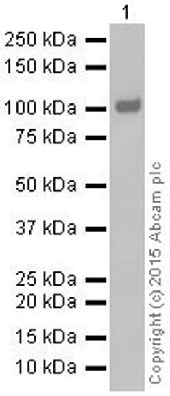 Western blot - Anti-HACE1 antibody [EPR7962] (AB133637)