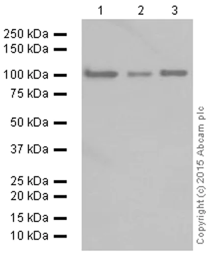 Western blot - Anti-HACE1 antibody [EPR7962] (AB133637)