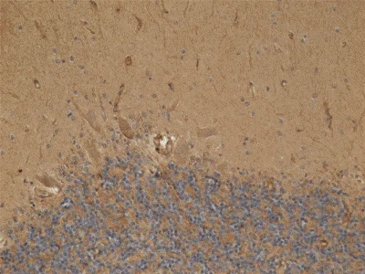 Immunohistochemistry (Formalin/PFA-fixed paraffin-embedded sections) - Anti-HADH antibody [1A12BC8] (AB110284)