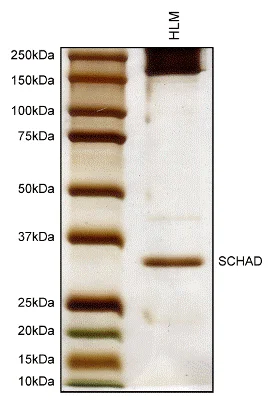 Immunoprecipitation - Anti-HADH antibody [1A12BC8] (AB110284)