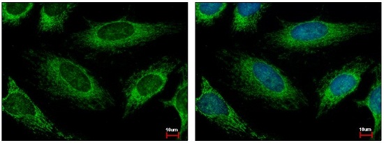 Immunocytochemistry/ Immunofluorescence - Anti-HADH antibody (AB154088), expandable thumbnail